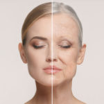 Comparison. Portrait of beautiful woman with problem and clean skin, aging and youth concept, beauty treatment