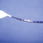 anorectal manometry picture 1
