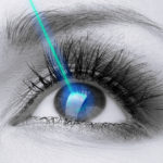 bw-eye-aqua-laser-1200×630