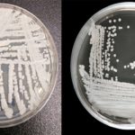 candida