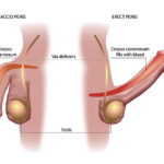 ed-penis-flaccid