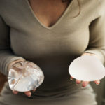 Woman holding silicon bags for breast implant
