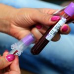 krv_medicina_laborarorij_03