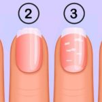 nail-health-750×430