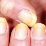 remove-nail