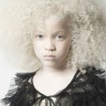 Albino
