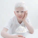 Albino2