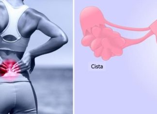 Голем број цисти на јачниците минуваат спонатно