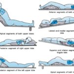 chest-physiotherapy-in-icu-22-638