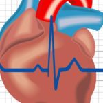 heartarrhythmia