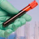 Green gloved hand holding blood sample in test tube