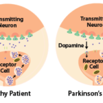 parkinsons_patients_have_less_dopamine