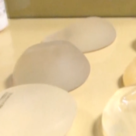 BHDN_HE-106WE_FILE_-ALLERGAN-BREAST-IMPLANTS-RECALLED-DUE-TO-C_CNNA-ST1-10000000054b933b_174_0.mp4.00_00_05_10.Still001-960×640