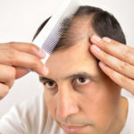 man controls hair loss with a comb