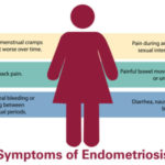 LLUCFF-endometriosis-symptoms-infographic-400×300