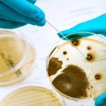 Agar plate with growing germs