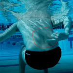 Lower-back-pain-after-surgery-738×535