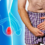 Testicular-cancer-Six-early-signs-and-symptoms-911581
