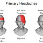 beautiful-headache-location-chart-with-types-of-headache-chart-hola-klonec-of-headache-location-chart