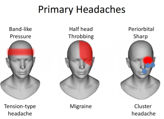 Different Types Of Headaches Chart