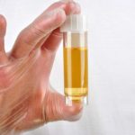 biomarker