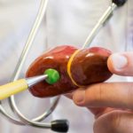 gallbladder model hero