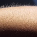 najezena-koza