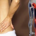 sciatica-s2-photo-of-lower-back-pain