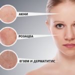 skin-problems