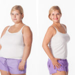 1695771_before-after_ff