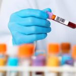 Blood-Test-Detects-Down-Syndrome-During-Pregnancy-722×406