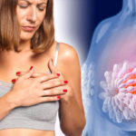 Breast-cancer-symptoms-Four-signs-the-disease-has-advanced-and-what-to-do-next-1022763