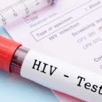 HIV