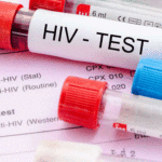 HIV1