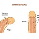 PENIS