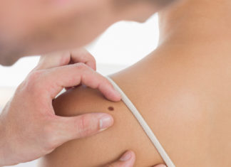 Три најчести прашања при отстранувањето бенки