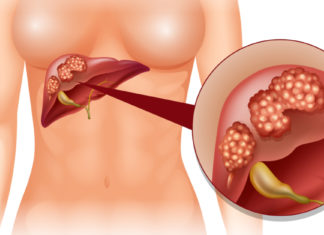 По ова ќе препознаете дека црниот дроб ви е полн со токсини