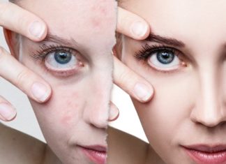 Зошто е важно навреме да се лекува атопискиот дерматитс