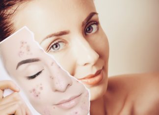 На кои промени на лицето мора да обрнете внимание?