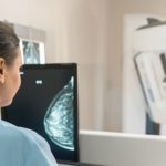 mammogram procedure