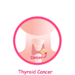 Thyroid-Cancer