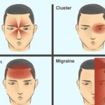 aid103131-v4-728px-Treat-a-Migraine-Step-1-Version-4