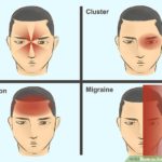 aid103131-v4-728px-Treat-a-Migraine-Step-1-Version-4