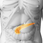 cancer-du-pancreas