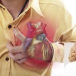 heart-attack-630×420