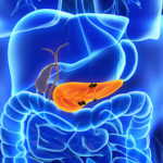 is_190819_pancreas_cancer_800x450