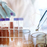 jednostavan_test_krvi_ucinkovit_u_otkrivanju_agresivnog_raka_prostate
