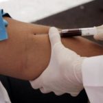 methemoglobinemia-what-it-is-causes_1