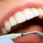 Mouth care