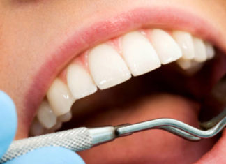 Болните непца поврзани со поголем ризик од хипертензија